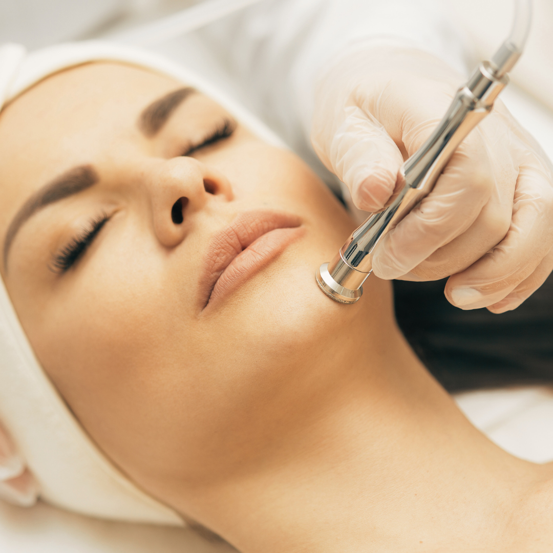 Microdermoabrasión con Puntas de Diamante | Exfoliación, luminosidad, renovación facial