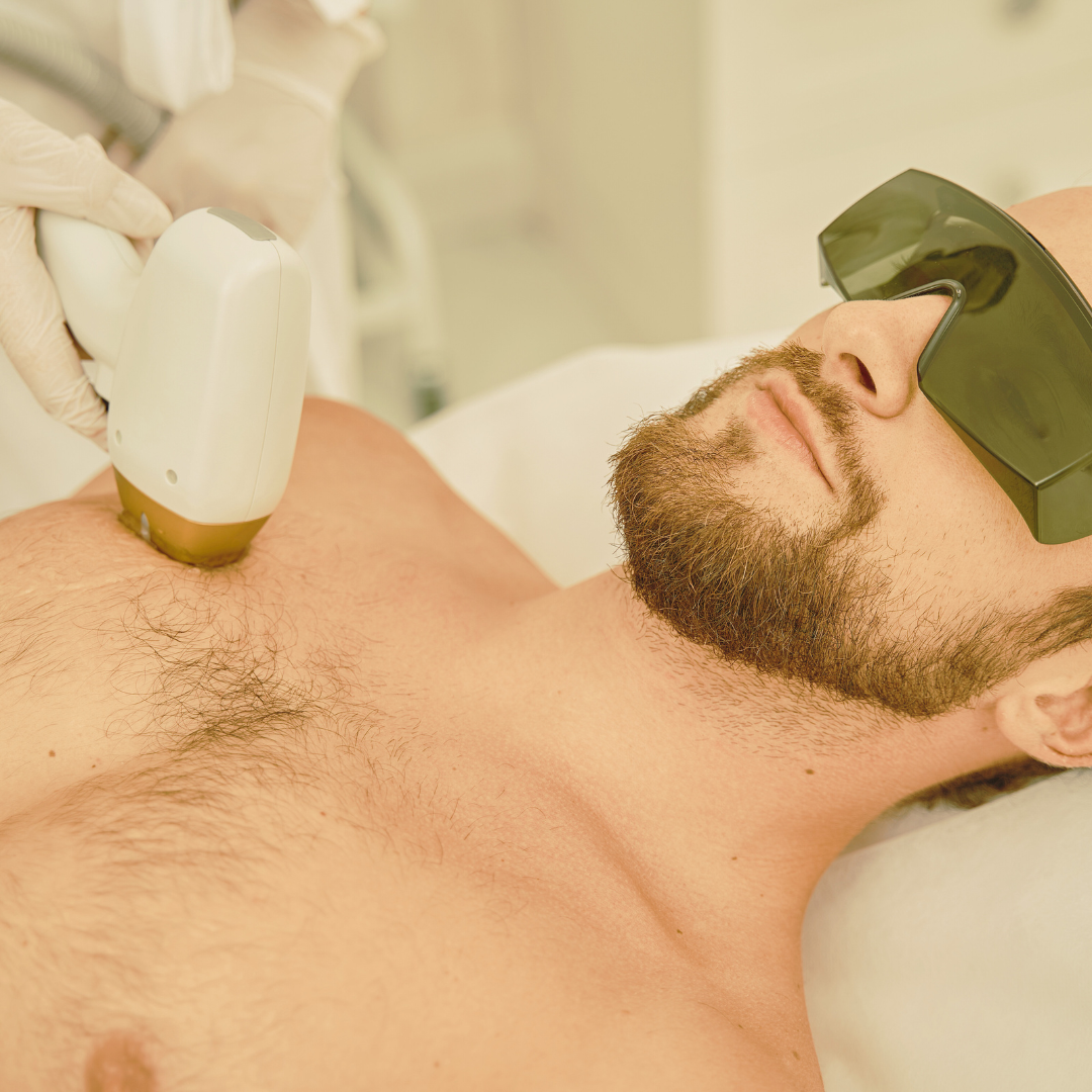 Depilación Facial y Corporal I Láser Diodo Dupplo | HOMBRE